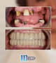 Slider image (8) IDC International Dental Clinic